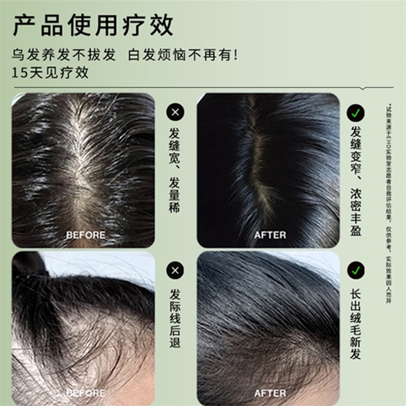 百禾心美何首乌护发肽精华乳
